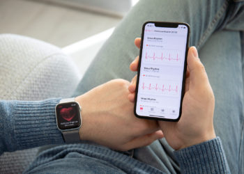 Apple Watch ECG